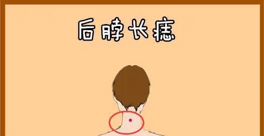 身上5颗靠山痣横财硬正财稳有车有房福泽子子辈辈