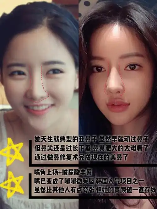 原来潘南奎这么成为女神整过不止一次?