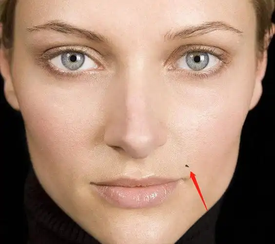 第三种,如果一个女人在嘴角上方长了一颗痣,这个痣叫做美人痣,也叫做