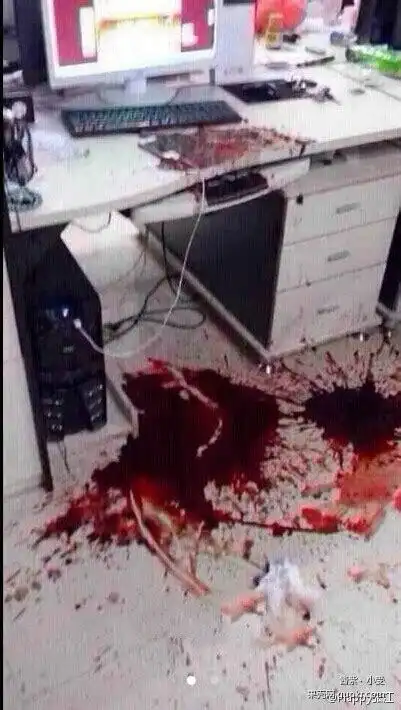 人被爆头脑浆图片2022已更新今日图集