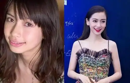 整牙前后的angelababy