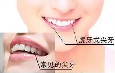 长虎牙是不是不好相学上_祖坟上长什么树好_黑痣上长毛 相学怎么说