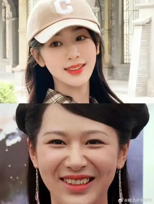 娱乐圈的哑巴新娘都整牙了 在娱乐圈里……|娱乐圈|哑巴新娘|宋轶