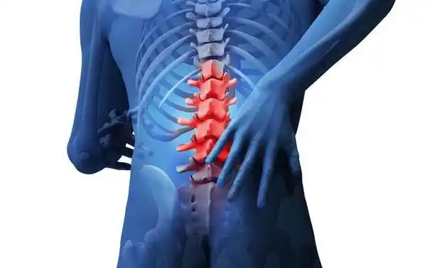 病例:椎间孔镜技术治愈腰4/5,腰5/骶1椎间盘突出症