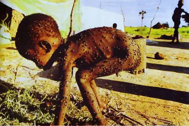 《非洲儿童》(世界摄影比赛金奖,图片来源)(红网论坛,寻原地址)