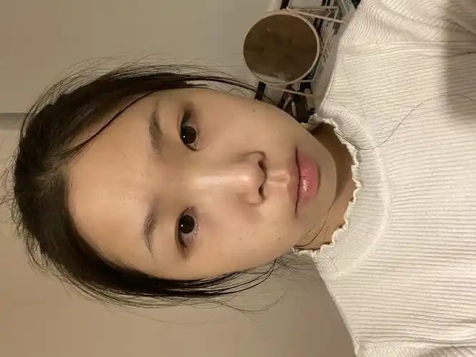 这种扁平脸要不要do鼻子