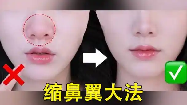 女子怀孕后鼻子变大两倍##缩鼻翼##怀孕不是女性一个