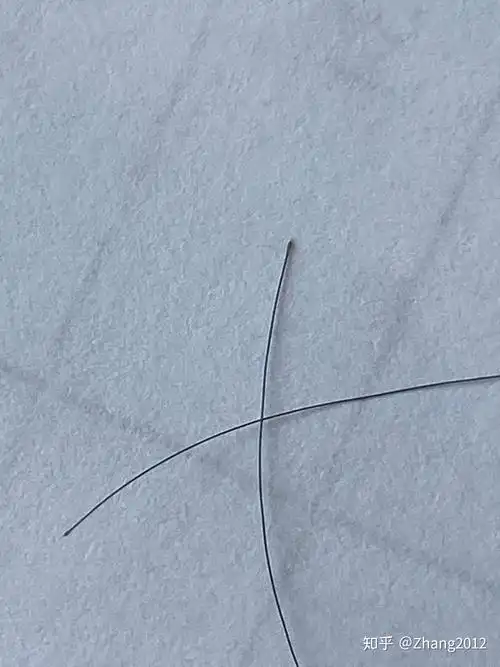 正常脱落的头发发根是什么样的