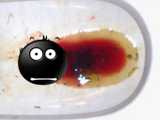 我是男的. 出血量如照片,是拉肚子.出血是