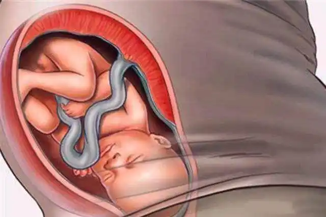 如何判断胎儿入盆啦这些感觉会提醒你