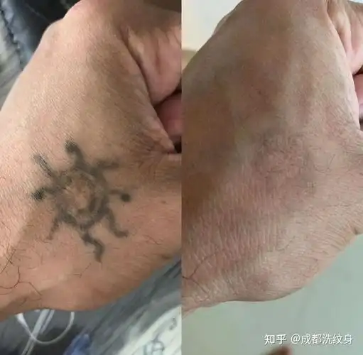 洗纹身后的十大注意事项