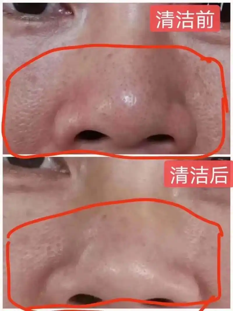 好皮肤是养出来的