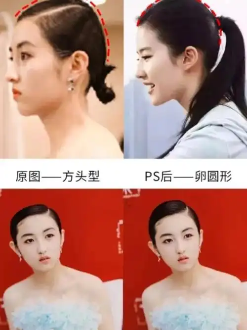 你脸大可能是颅顶低