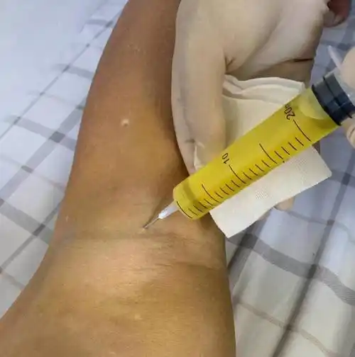 患者_医生_运动