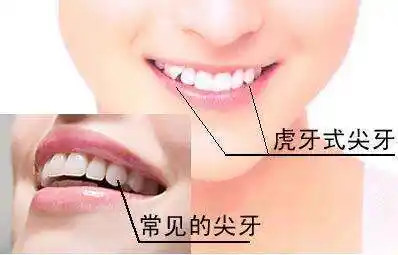 为什么虎牙不能拔掉?