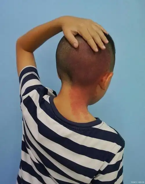 孩子总歪着脖子要警惕!