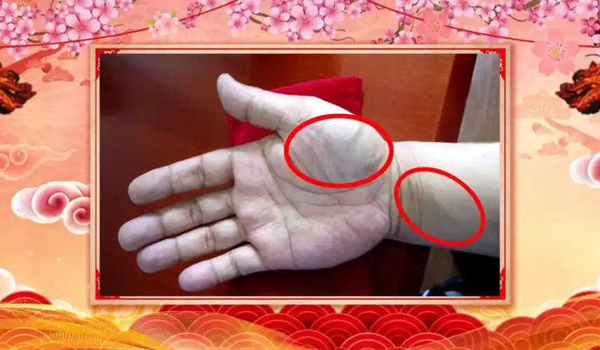 手掌这里有青筋当心健康亮红灯赶紧自查