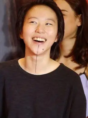 下巴那条线是什么为什么时有时无背后有啥寓意(窦靖童面相下巴痣)