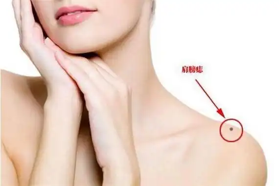 肩膀上有痣的意思有哪些?