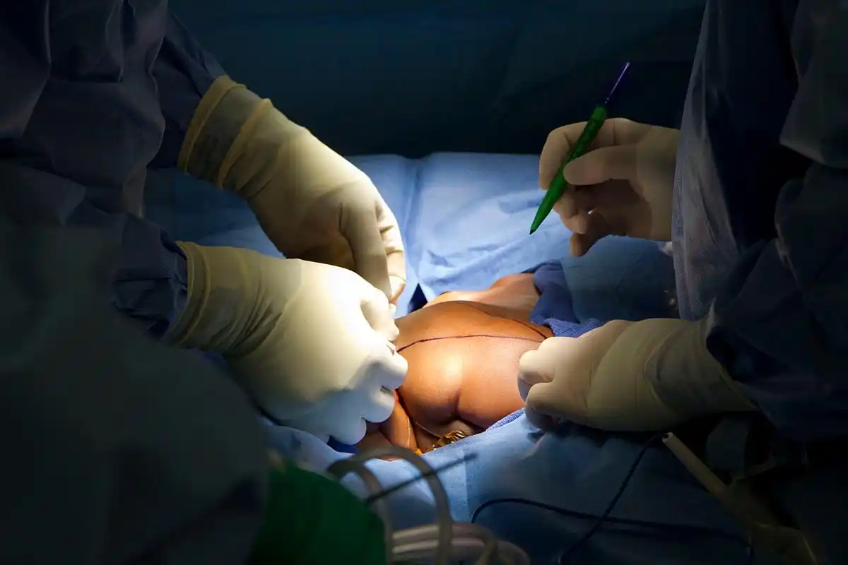 近日,福建福州一名六岁男孩做完包皮手术后十天离世,引发社会广泛关注