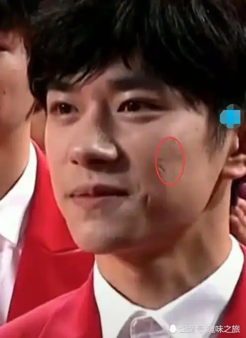 千玺我脸上长痘了王俊凯我脸上也长痘了王源看看我再说