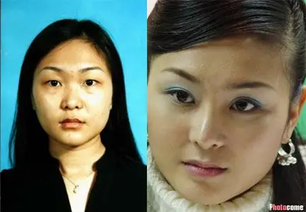 中国第一人造美女郝璐璐整容接近尾声组图