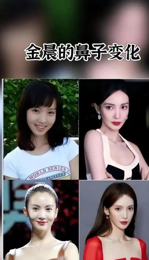 出道似整容!天庭饱满地阁方圆的金晨,原来12年前和现在判若两人