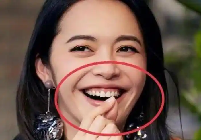刘涛牙齿脱落,吴宣仪嘴巴合不上,明星们的大白牙真的好看吗?