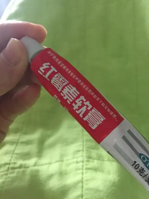 因乳头疼痛,摸了红霉素软膏,喂宝宝之前忘记清洗就喂了,宝宝吃进去了