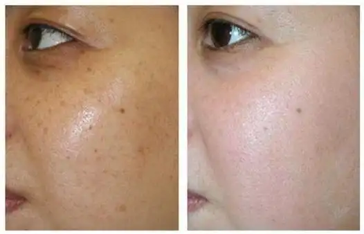 想要去除肌肤黄气和暗沉?做好这三步,皮肤透亮不化妆也好看