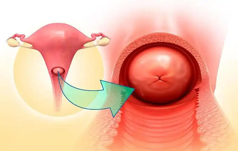 子宫颈肥大_子宫颈肥大治疗方式 - 好大夫在线