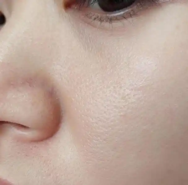 脸上毛孔粗大有什么方法修复?这几个小技巧,简单在家就能做!