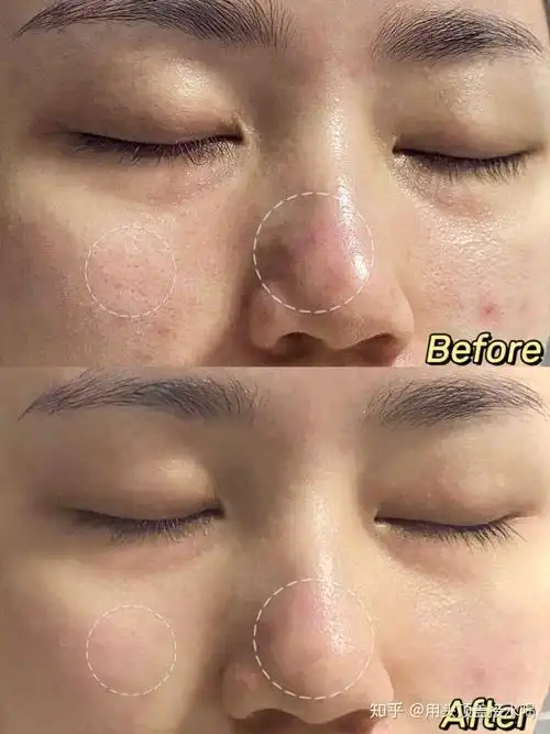 有什么护肤品让你用完之后逢人就推荐?