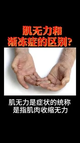 甚至周围神经损害,运动神经元病都可以有肌无力症状