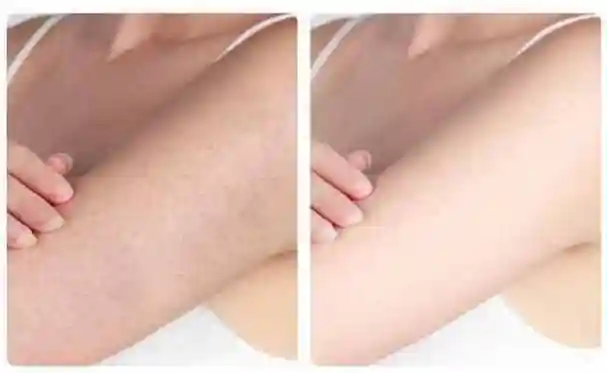 做到这2件事,去除鸡皮肤,光滑细腻皮肤好