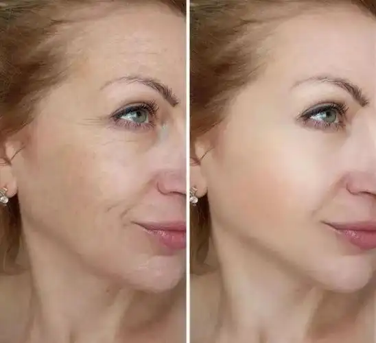 紧致皮肤最有效的方法是什么