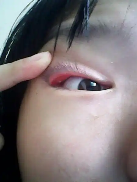 这是什么,怎么办?