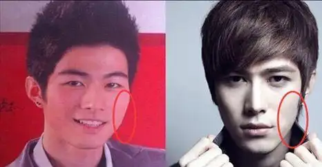 男星整容前后差距巨大,黄晓明变男神,陈伟霆像换脸,你还知道谁|整容