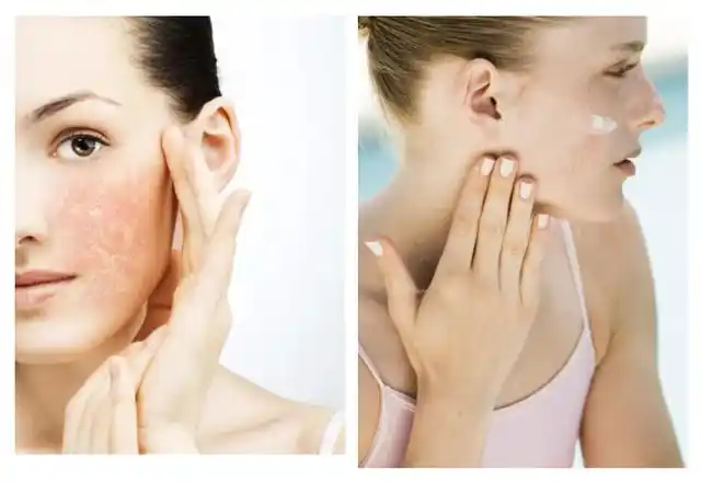 你暗沉敏感初老脆弱肌有救了快把皮肤软黄金带回家