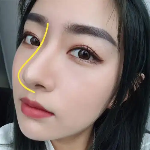 你高鼻梁鼻子增高男女鼻夹缩小鼻翼挺鼻矫正化妆