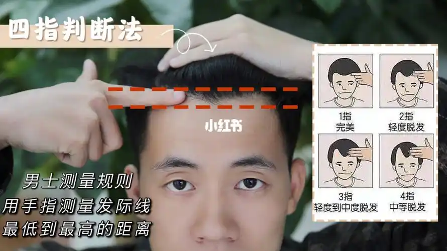 91秒 测测你的发际线有多高_发际线_脱发_眉毛_防脱_小镜子_美妆