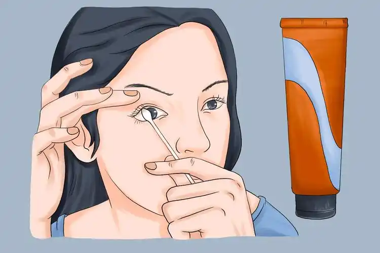 眼膏涂入上眼睑内图解_有来医生