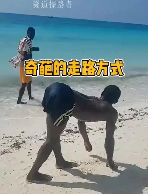 走路姿势太搞笑,这些奇葩步态你见过吗?