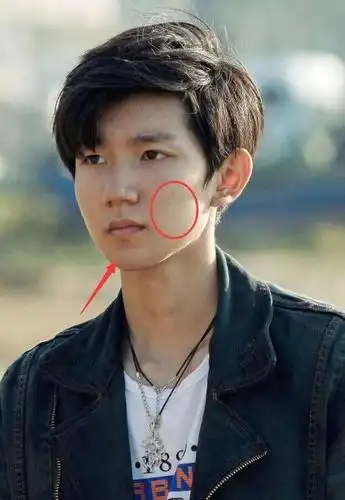 王源皮肤状态超差?节目组失误忘开滤镜,王源满脸痘颜值下跌