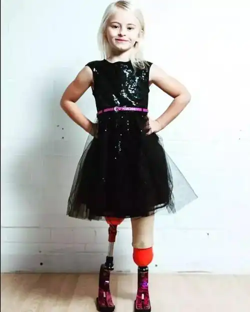 9岁小仙女红遍全球双腿截肢美若天仙她用勇气和笑容创造历史