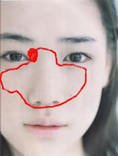 面部三角区粗糙 起小疙瘩 请给详细的方法 谢谢