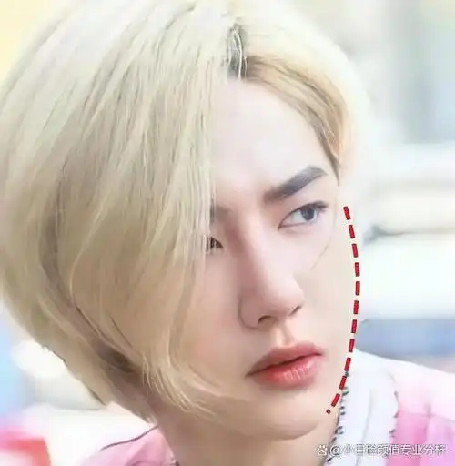 整形医生:还有人说王一博动过脸,给他看这篇就够了