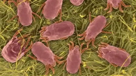 脸上容易起痘痘? 注意是不是床上滋生螨虫