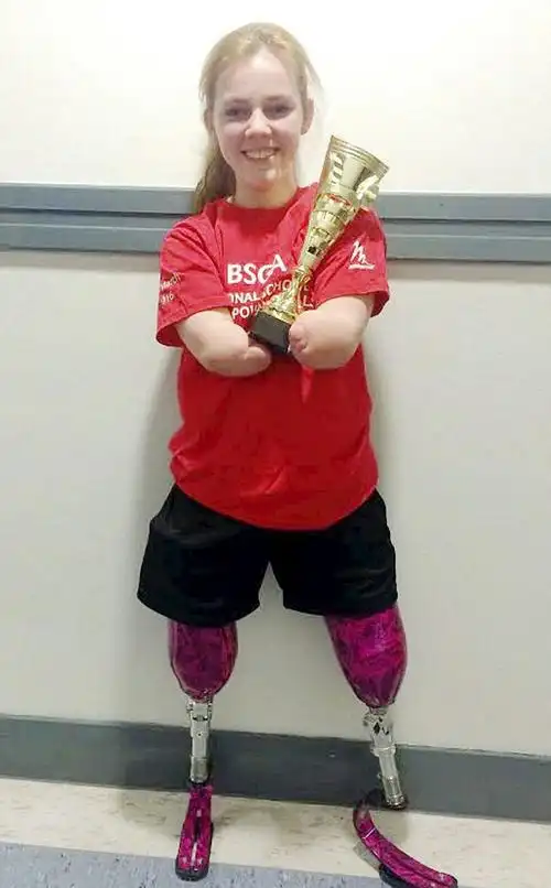 尼日利亚天生无四肢女孩圣诞节去世