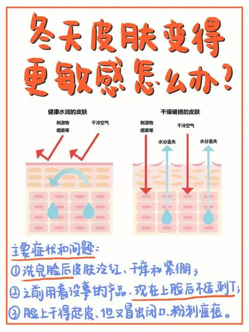 深度解析冬季皮肤敏感75你中招了吗71